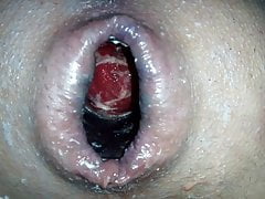 Anal insertion i6