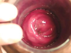 Gaped fuckhole March-15-2015