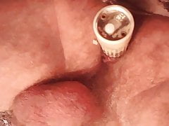 Anal